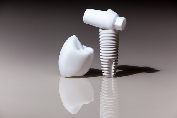 Laboratoire dentaire à Lille (Fourmies) : Implant dentaire zircone img